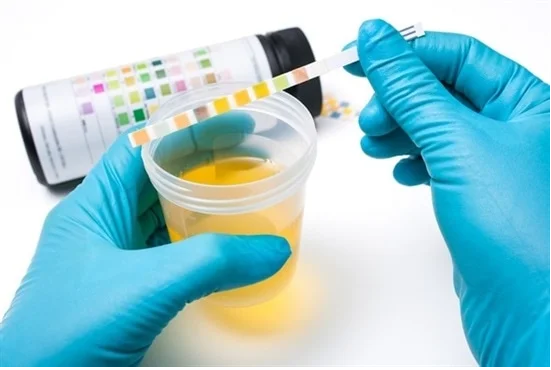 Urine Testing & Collection