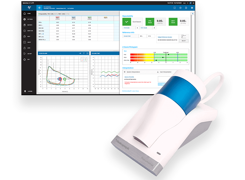 Vitalograph Pneumotrac PC-Based Spirometer with Spirotrac Software | Medical Supermarket