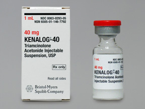 [AMB] (POM) Kenalog - 40mg/1ml - 1ml Vial - (Pack 5) | Medical Supermarket